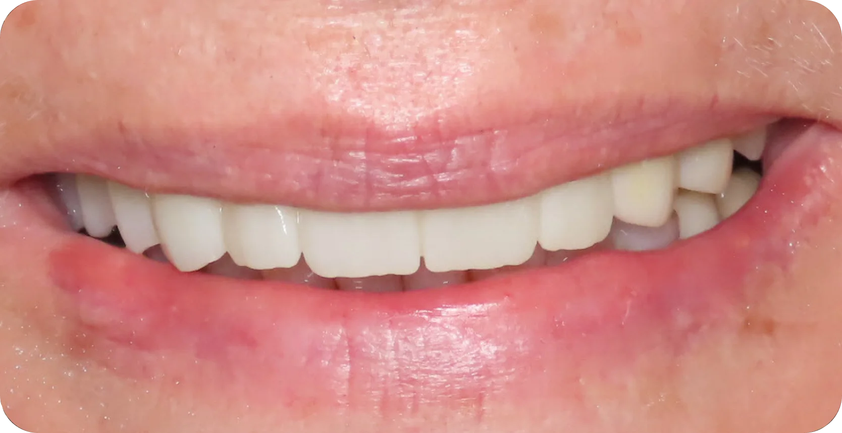 After Image