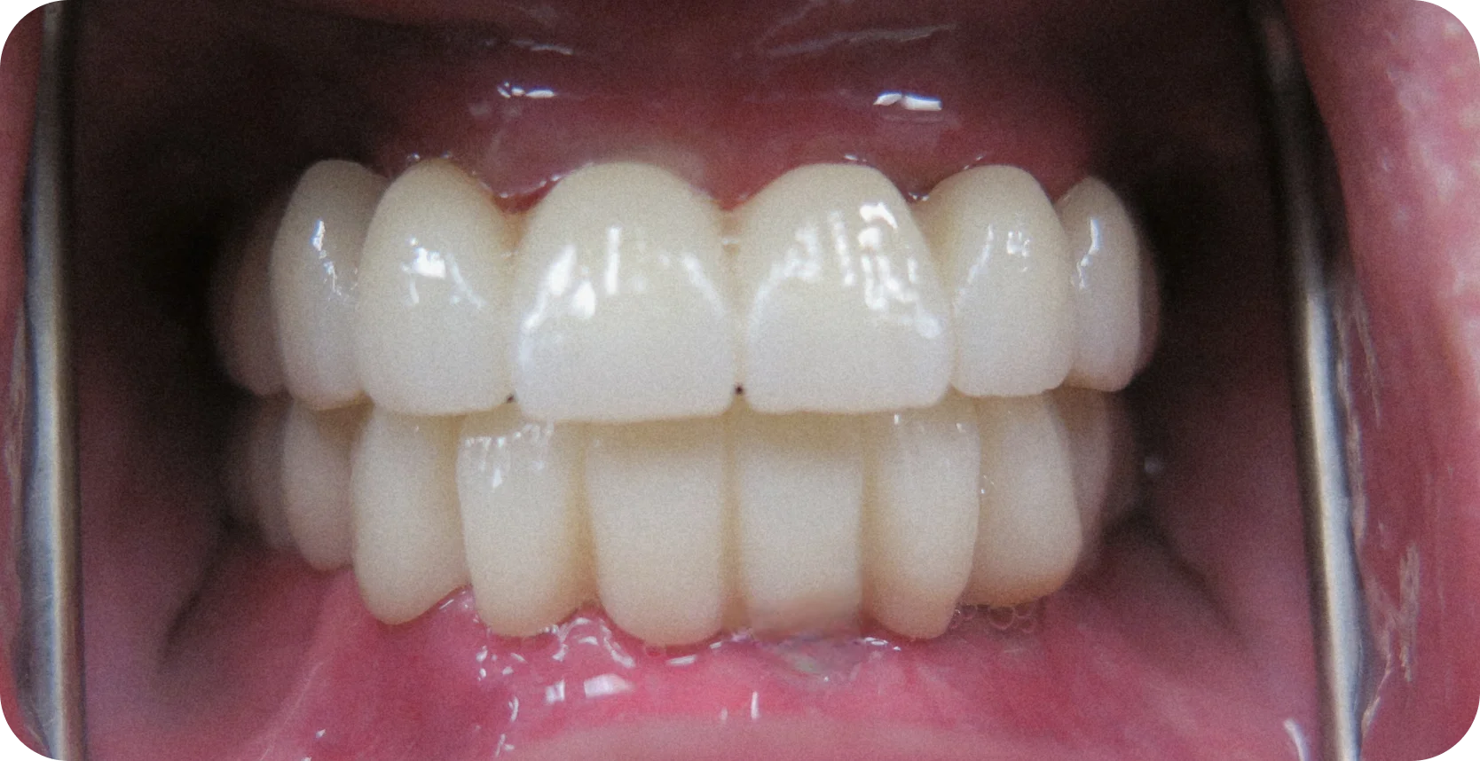 After Image