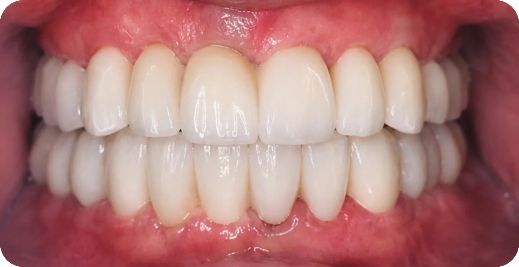 After Image