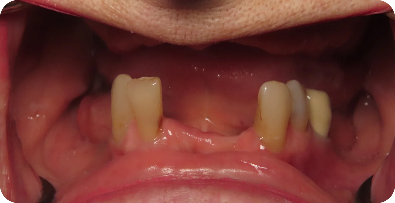 Before Image