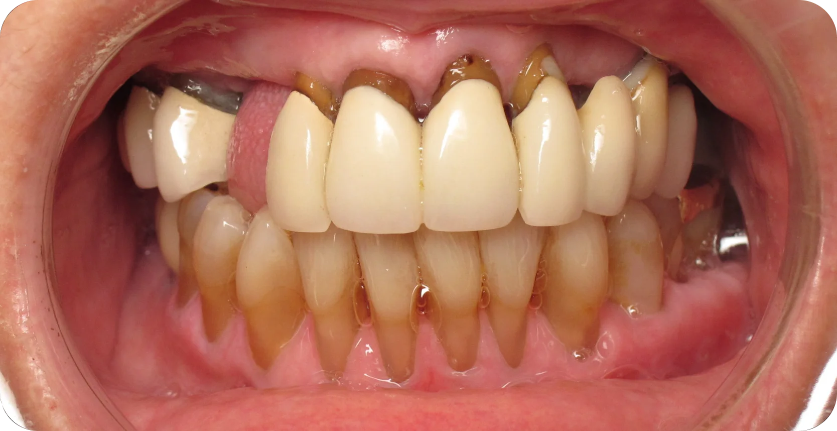 Before Image