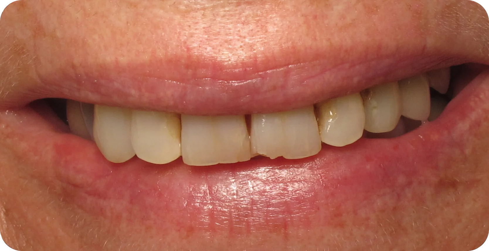 Before Image