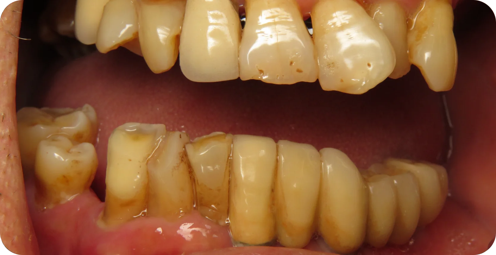Before Image