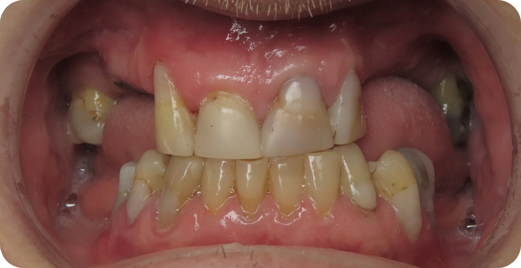 Before Image