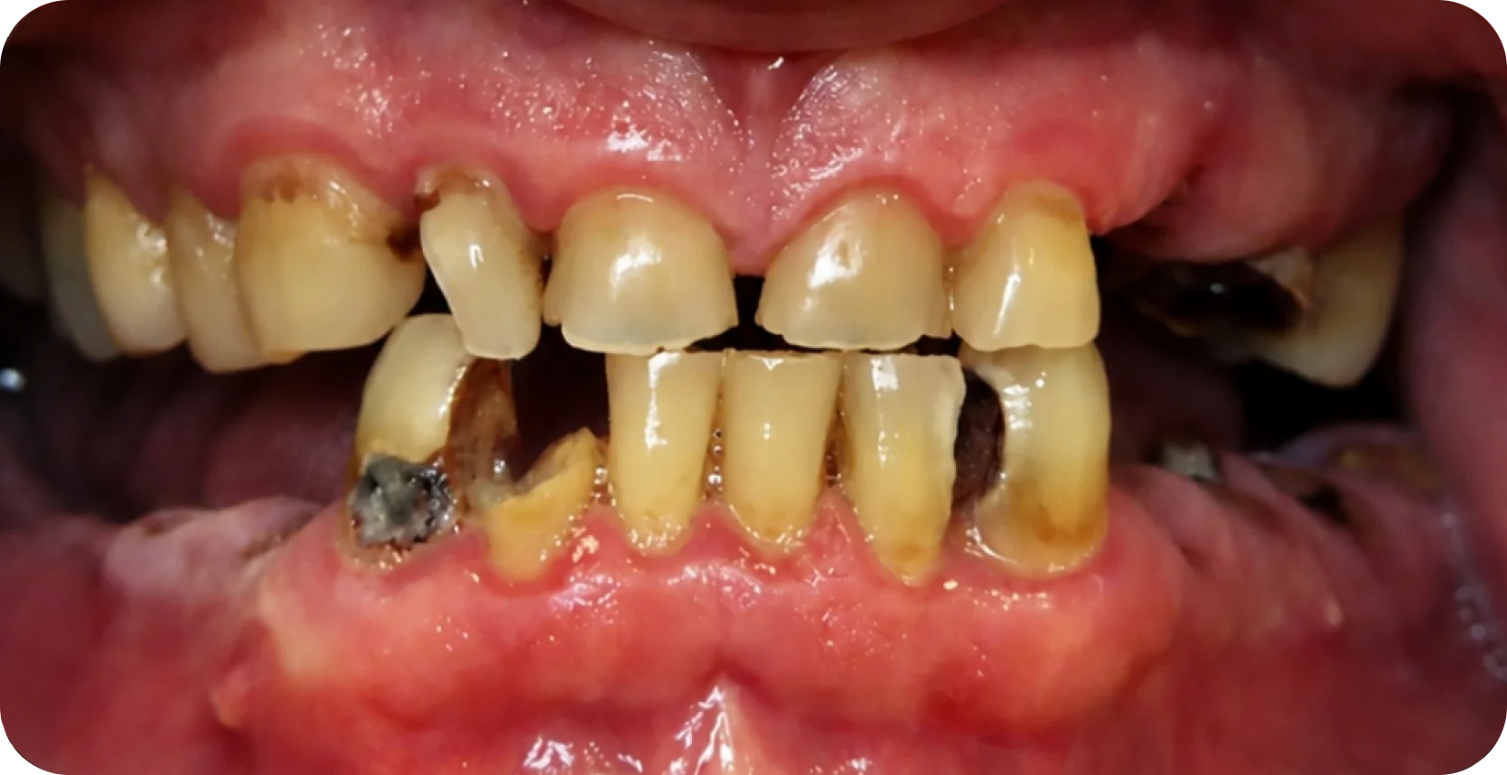 Before Image