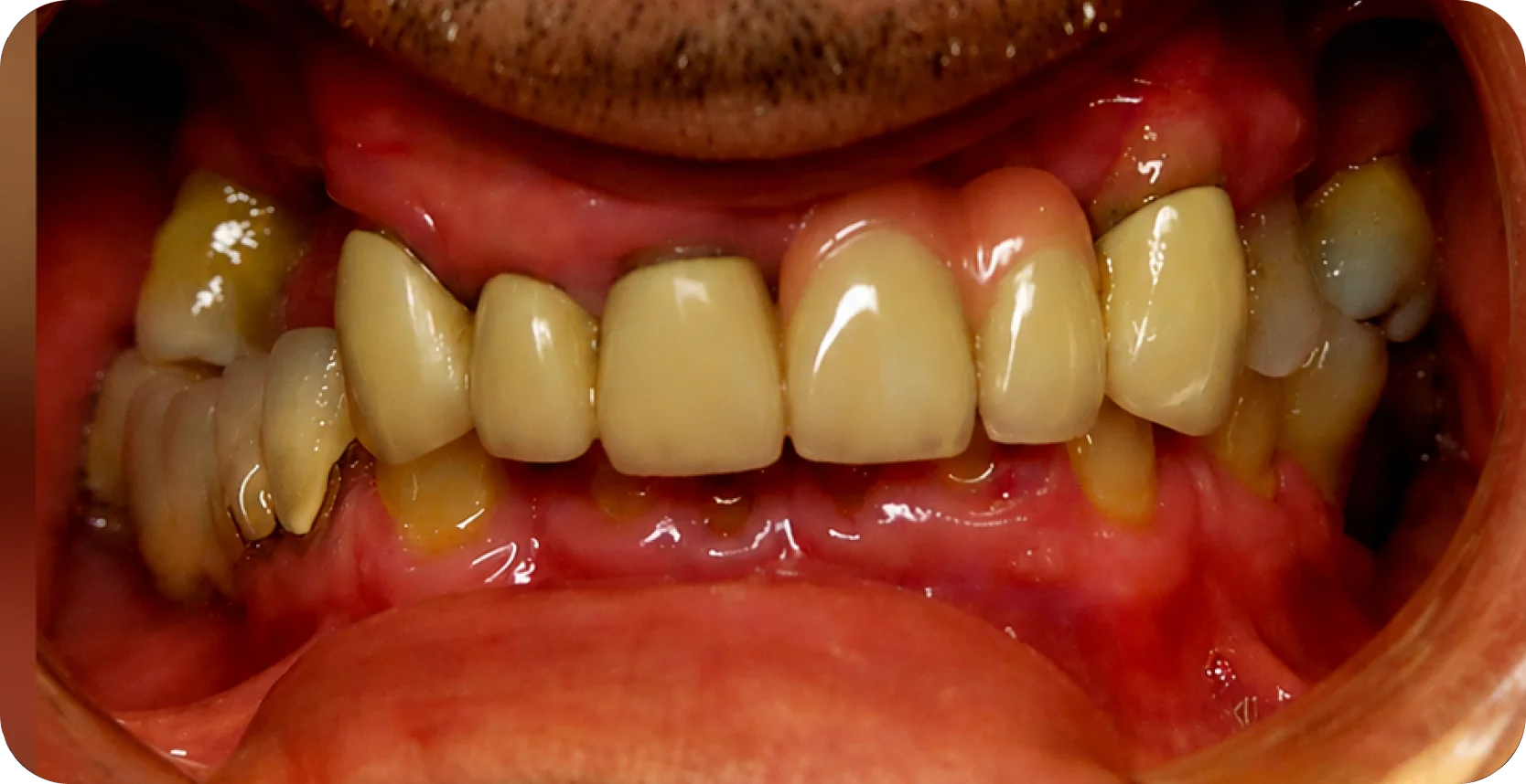 Before Image